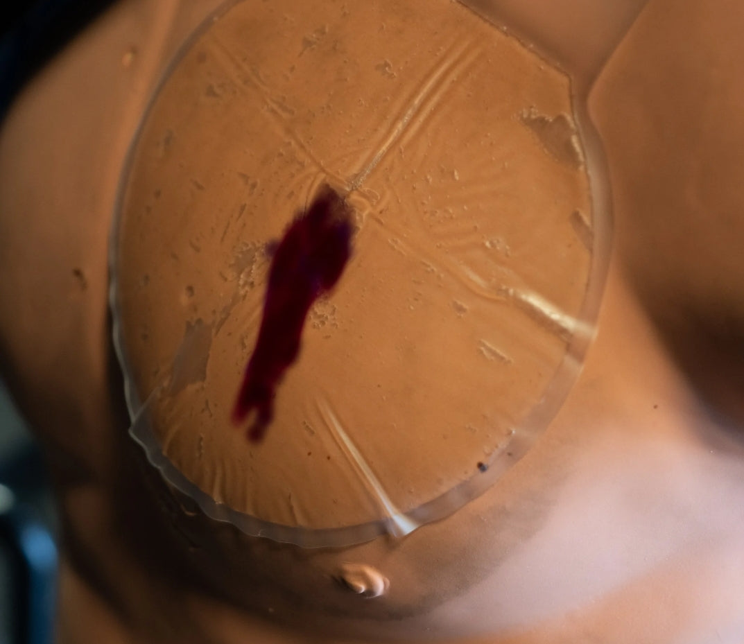 2x ChestSeal Greendevil + 1x Entlastungspunktionsnadel