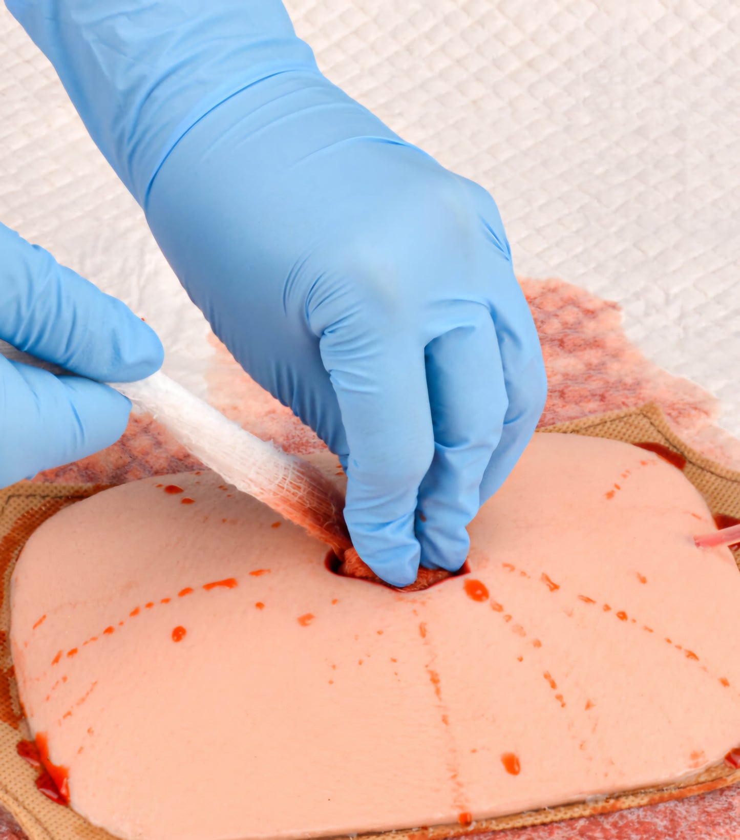 Compressed Gauze